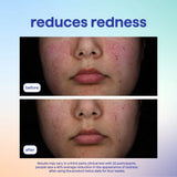 skin spritz face mist